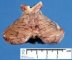 Brainstem and cerebellum (1 month)