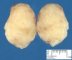 Mammary fibroadenoma
