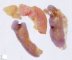Fetal ovaries 20 weeks