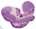 Fetal testis 21 weeks