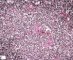 Fetal thymus 25 weeks