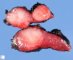 Thyroid papillary carcinoma
