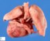 Dextrocardia in situs inversus (24 weeks)