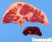 Liver ischemia in neonatal shock with DIVC
