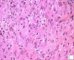 Epithelioid cells in epithelioid granuloma