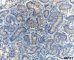 Germ cell proliferation in cryptorchidism (CD117)