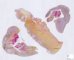 Fetal ovaries 31 weeks