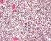 Fetal ovary 25 weeks