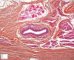 Thyroglossal tract