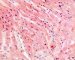 Normal cardiomyocytes (HE)