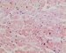Normal cardiomyocytes (HE)