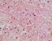 Normal cardiomyocytes (HE)
