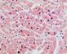 Normal cardiomyocytes (HE)