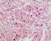 Normal cardiomyocytes (HE)