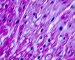 Normal cardiomyocytes (PAS)