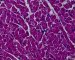 PAS stain of normal cardiomyocytes