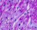 Normal cardiomyocytes (PAS)