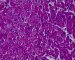 PAS stain of normal cardiomyocytes