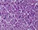 PAS-diastase stain of normal cardiomyocytes