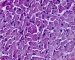 PAS-diastase stain of normal cardiomyocytes