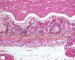 Fetal colon 24 weeks
