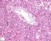 Fetal liver 21 weeks
