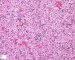 Fetal liver 21 weeks