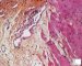 Digestive GVH