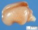 Fetal brain 12 weeks