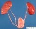Ureteral duplication without obstruction
