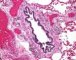 Bronchiole