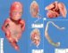 Caudal regression complex
