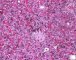 Fetal liver 20 weeks