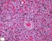 Fetal liver 20 weeks