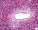 Fetal liver 20 weeks