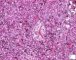 Fetal liver 20 weeks