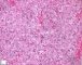 Fetal liver 21 weeks