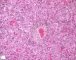 Fetal liver 21 weeks