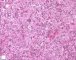 Fetal liver 21 weeks