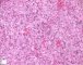 Fetal liver 21 weeks