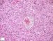 Fetal liver 21 weeks
