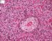 Fetal liver 22 weeks