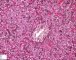 Fetal liver 22 weeks
