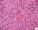 Fetal liver 14 weeks