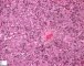 Fetal liver 14 weeks