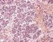 Fetal pancreas 25 weeks