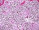 Fetal testis (22 weeks)