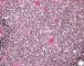 Featl thymus 25 weeks