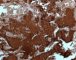 NSE staining in immature paraganglioma of the vesical region