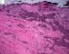 Mediastinal poorly differentiated neuroblastoma (Case 11541)